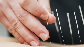 physiotherapist dry needling